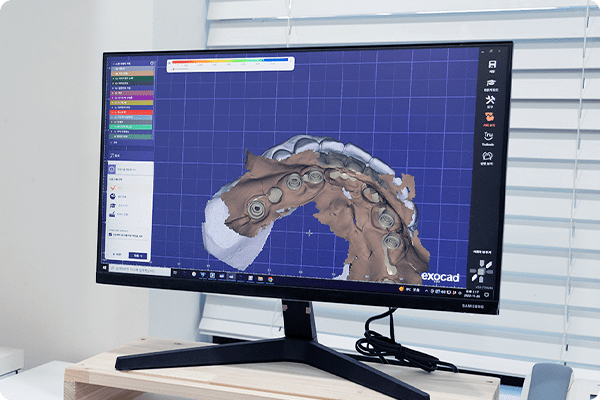 3D 보철물 디자인