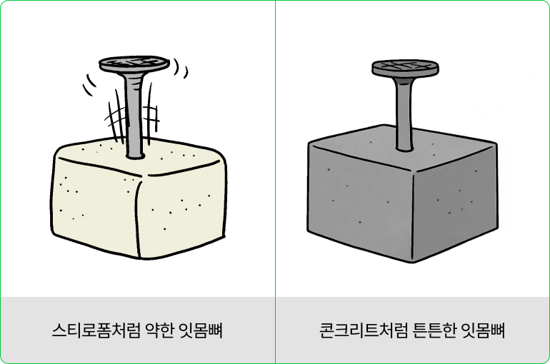 초기 고정력을 극대화해, 약한 잇몸뼈에도 안정적으로 고정