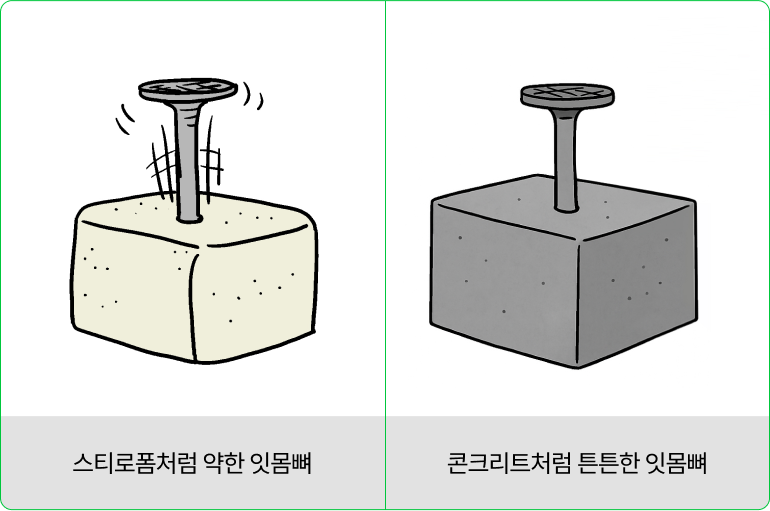 시니올 임플란트