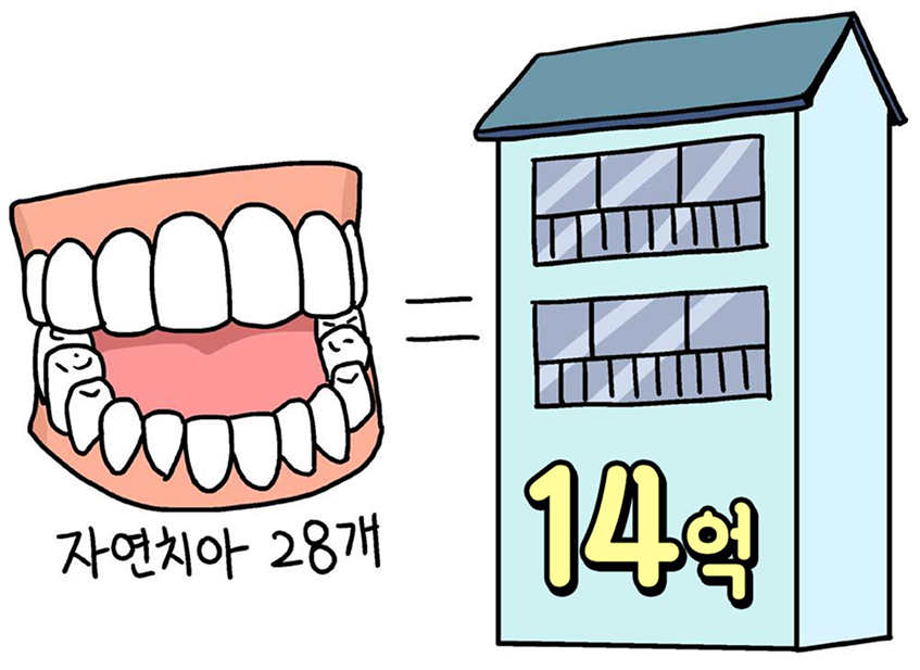 자연치아 비용