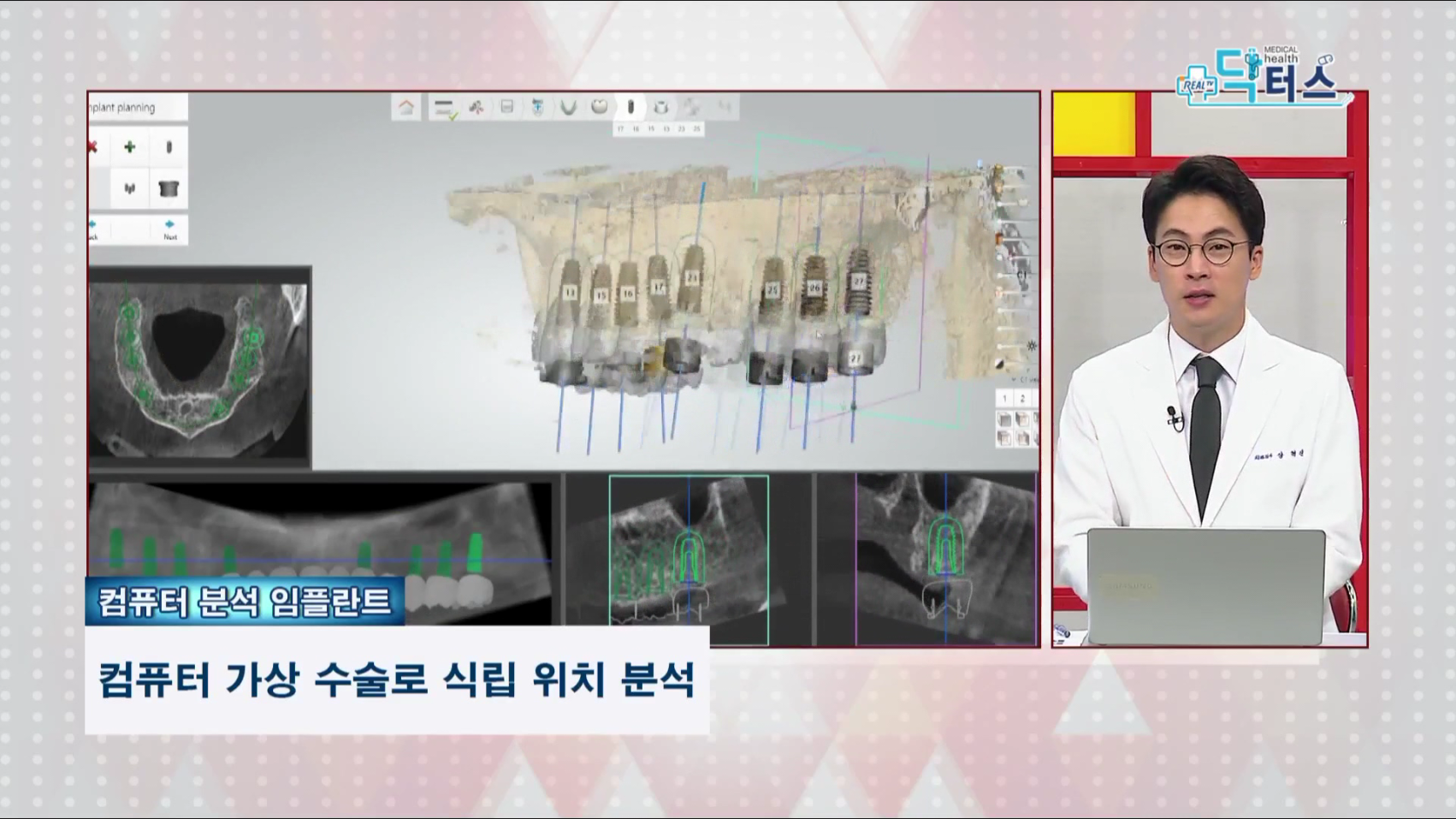 공지사항 썸네일
