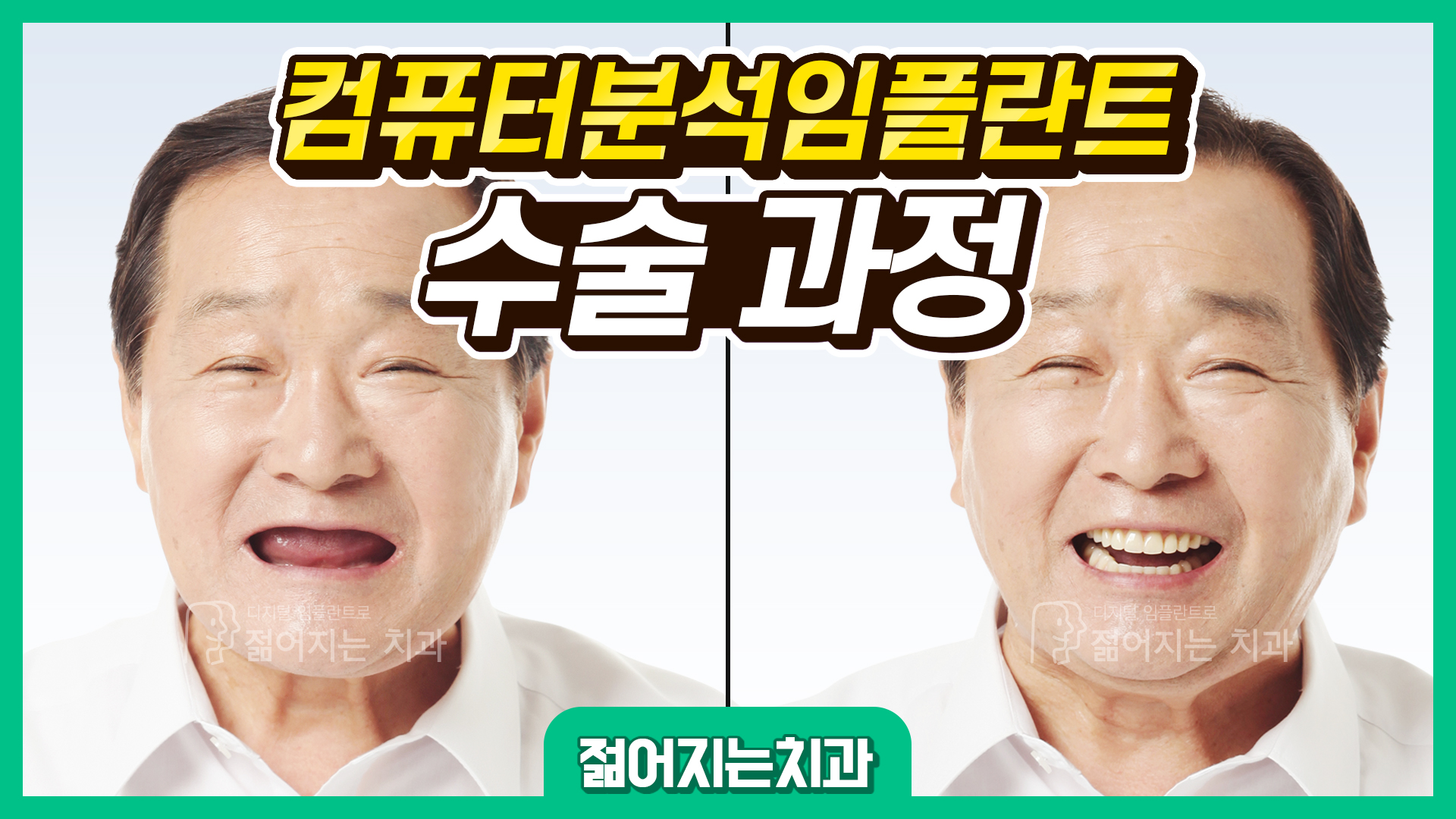 공지사항 썸네일