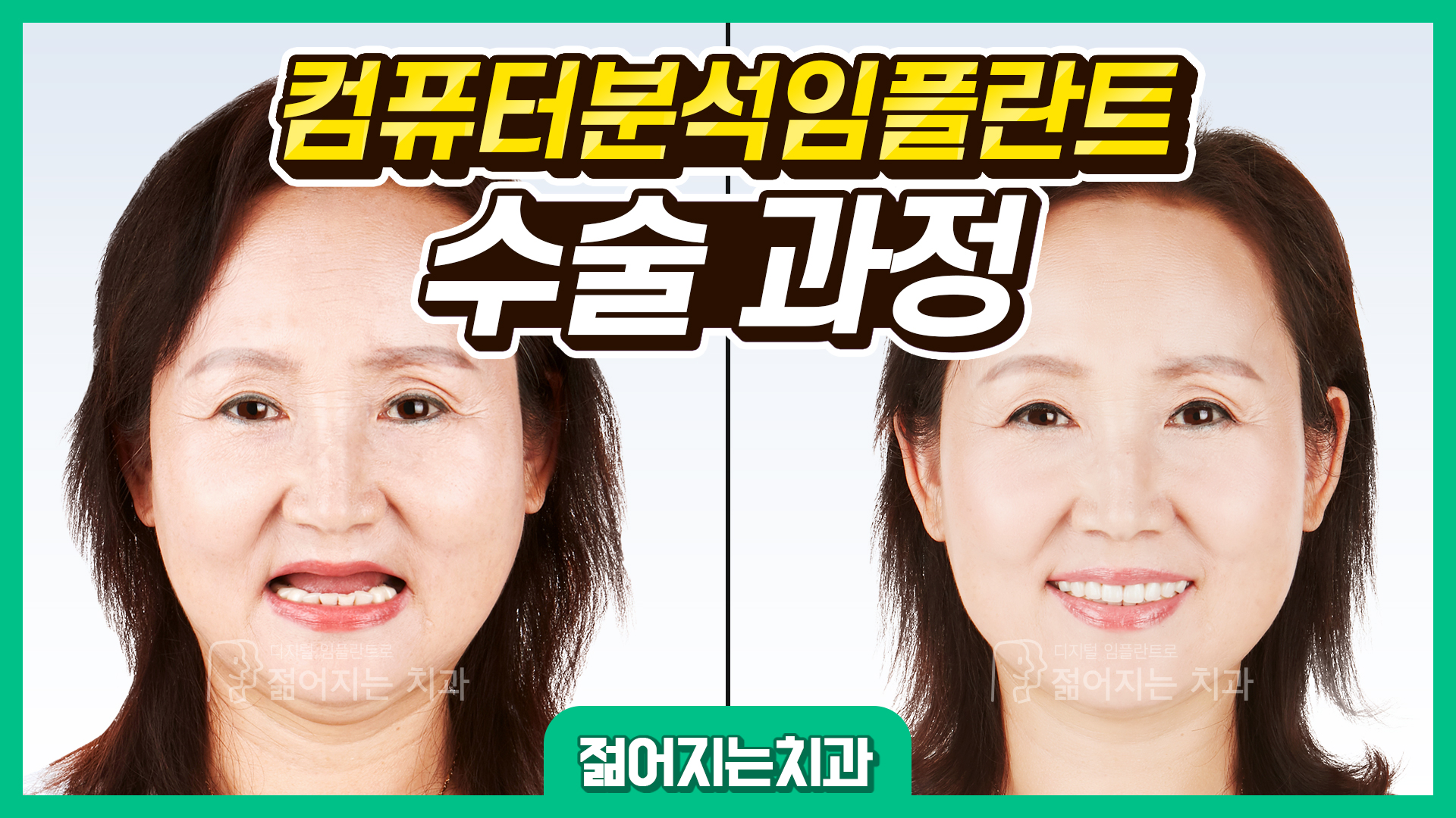 공지사항 썸네일
