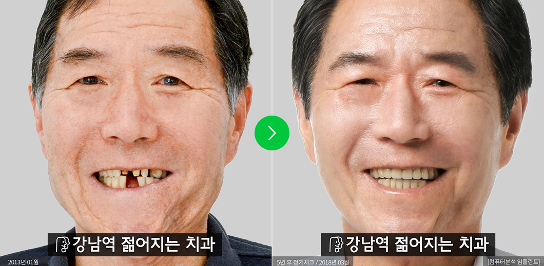 전후사진